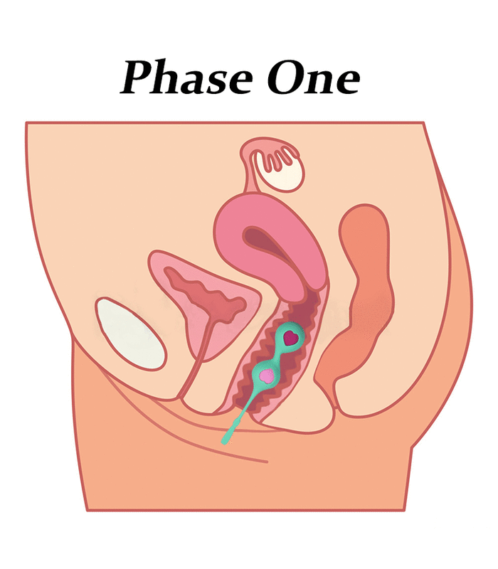 Silikon Kegel Balls-Training-Set 3 Stück Schrittweise Stärkung der PC-Muskel - Grün